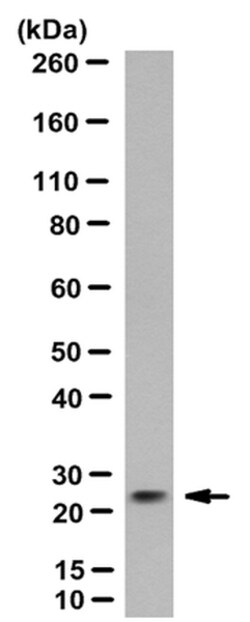 MilliporeSigma Rabbit anti-CTHRC1, Clone: Vli-55, 200&mu;g:Antibodies,